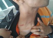 Oknum DC Dilaporkan ke Polrestabes Surabaya,Diduga Melakukan Tindakan Intimidasi dan Kekerasan