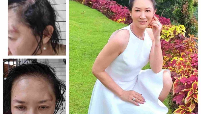 Sherly Chebing Bangkit dari Trauma, Menjadi Suara bagi Korban Kekerasan