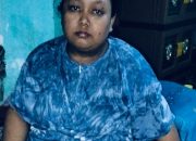 15 Tahun menderita Kaki Gajah, Eni Warga Rejoso, Pasuruan butuh kepedulian ekstra Pemerintah