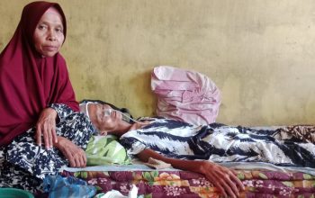Mengidap Tumor Otak Stadium 4 Salbiah Butuh Uluran Tangan Dermawan